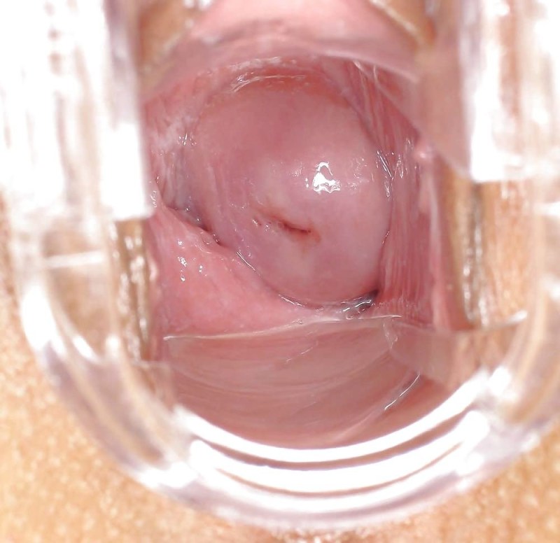 Vagina and uterus from the inside