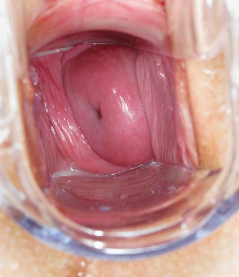 Healthy vagina inside