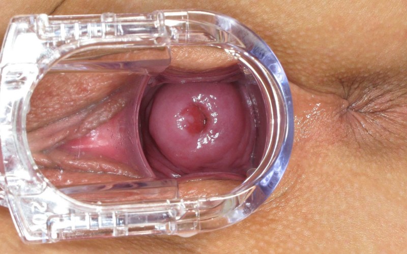 The vagina of a woman from the inside
