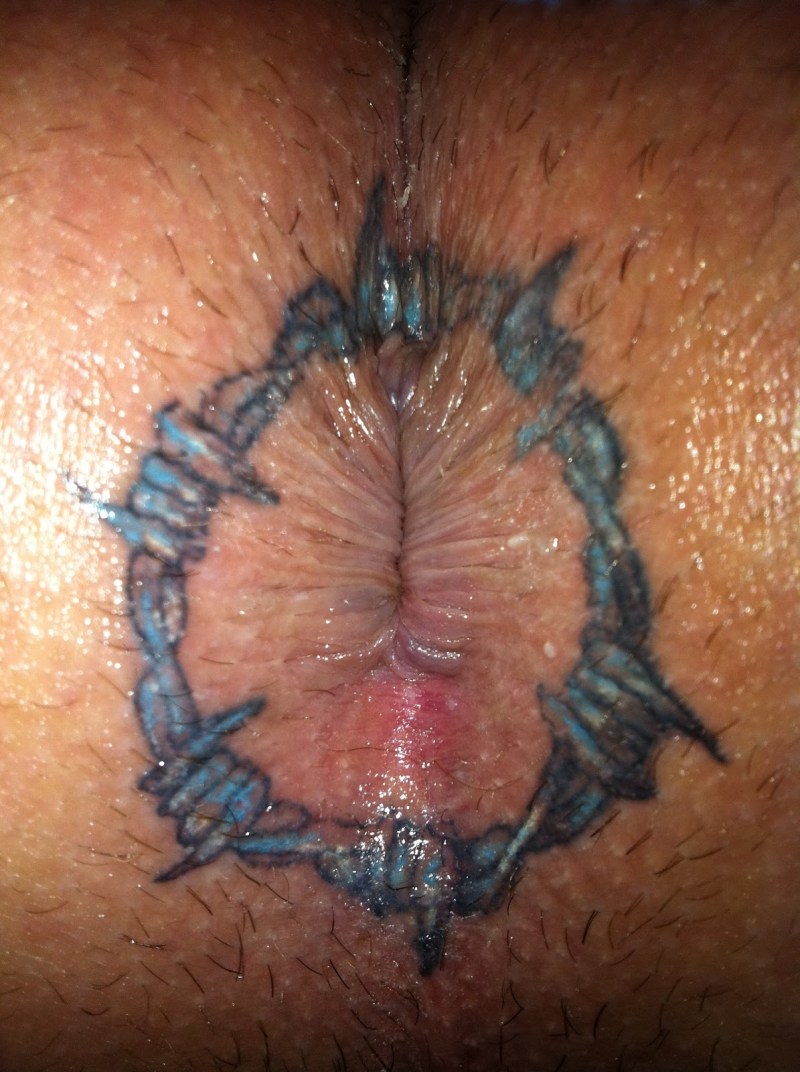 Tattoo around the anus