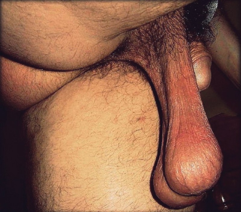 Sprinkable big scrotum