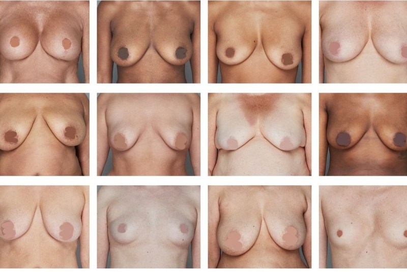 Naked chest of different shapes