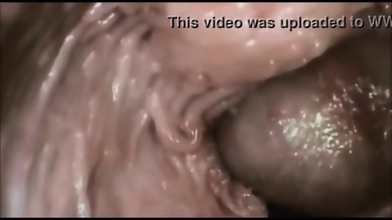 The camera inside the vagina