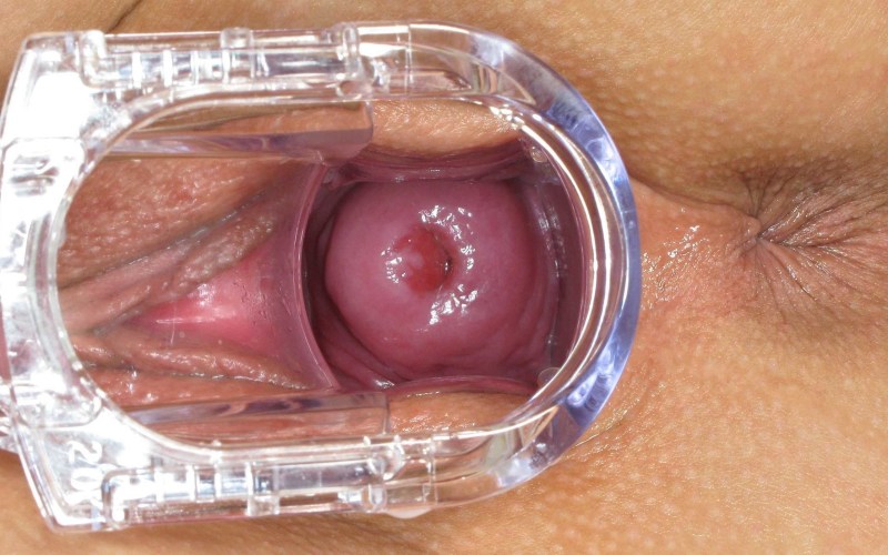 Healthy vagina from the inside