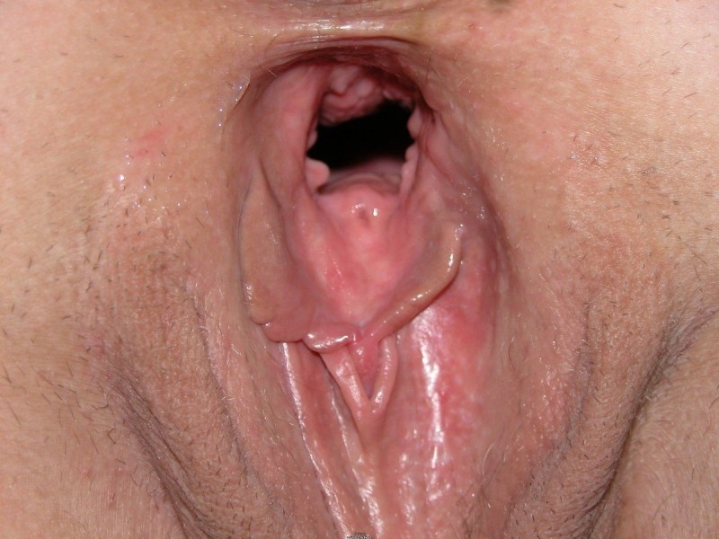 Inside the vagina is large