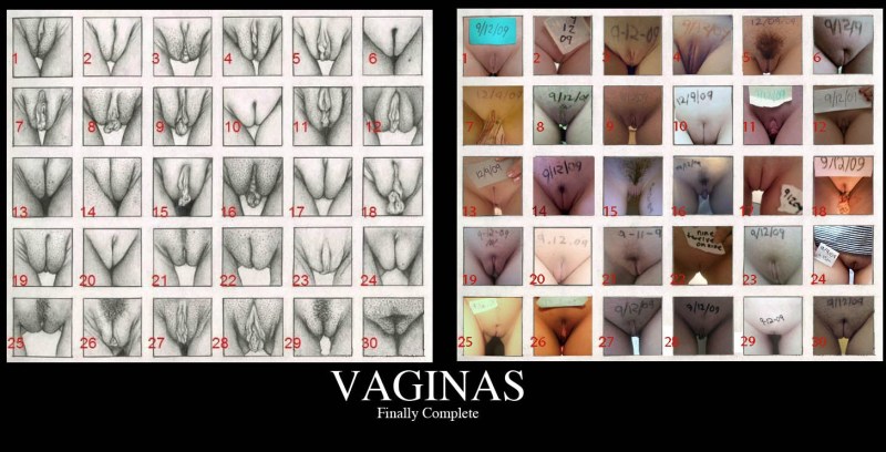 Forms of female vagina with names