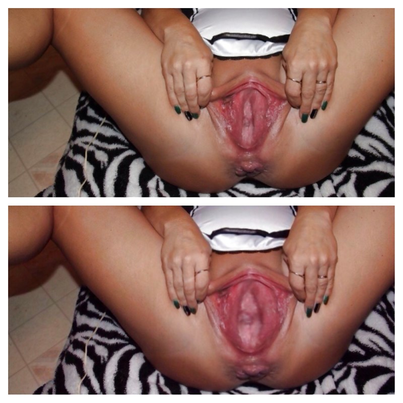 Vagina before and after losing weight