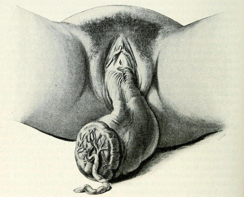 Pictures with the image of the vagina