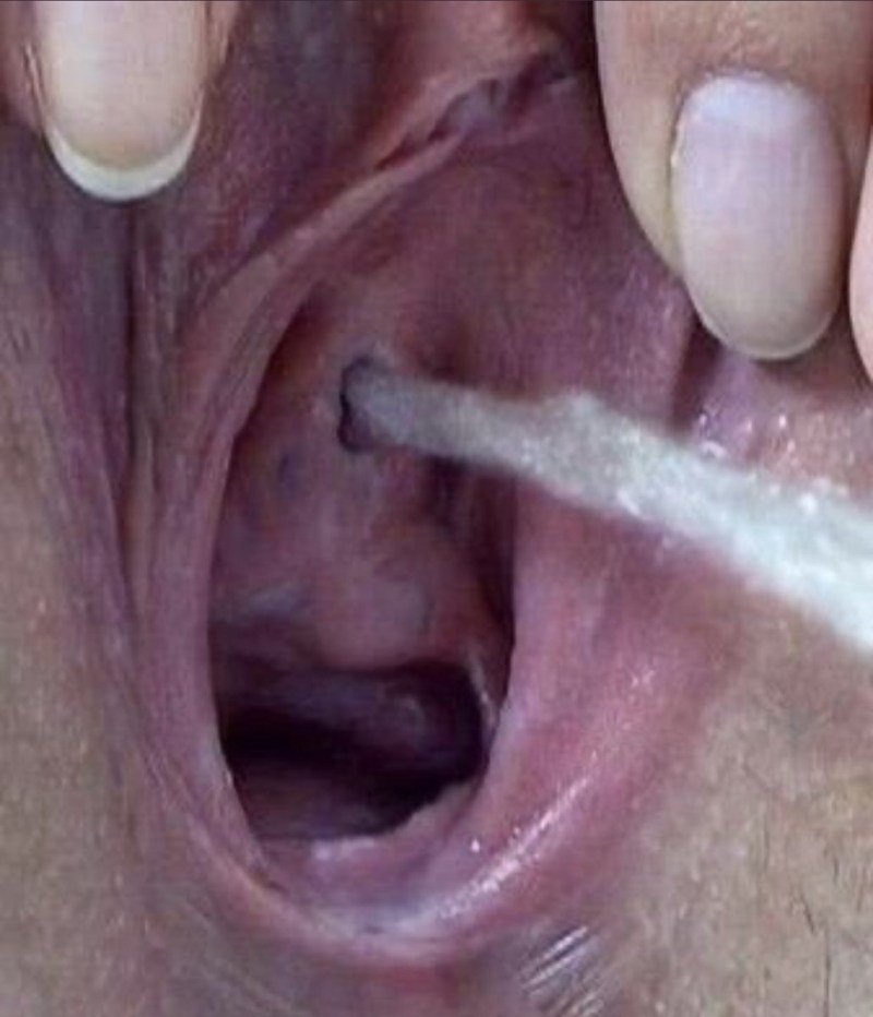 Women's urethra is large