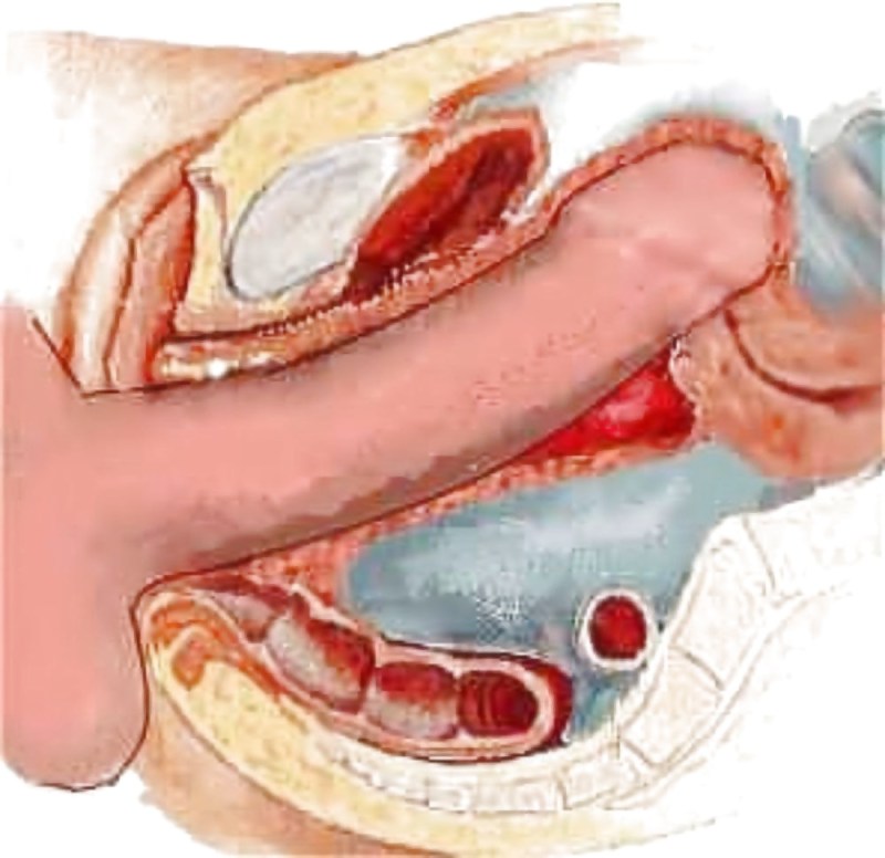 Skp dick in the vagina of a woman