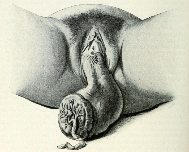 Pictures with the image of the vagina